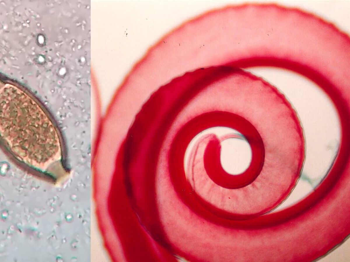 Cyclothymie et surdoué